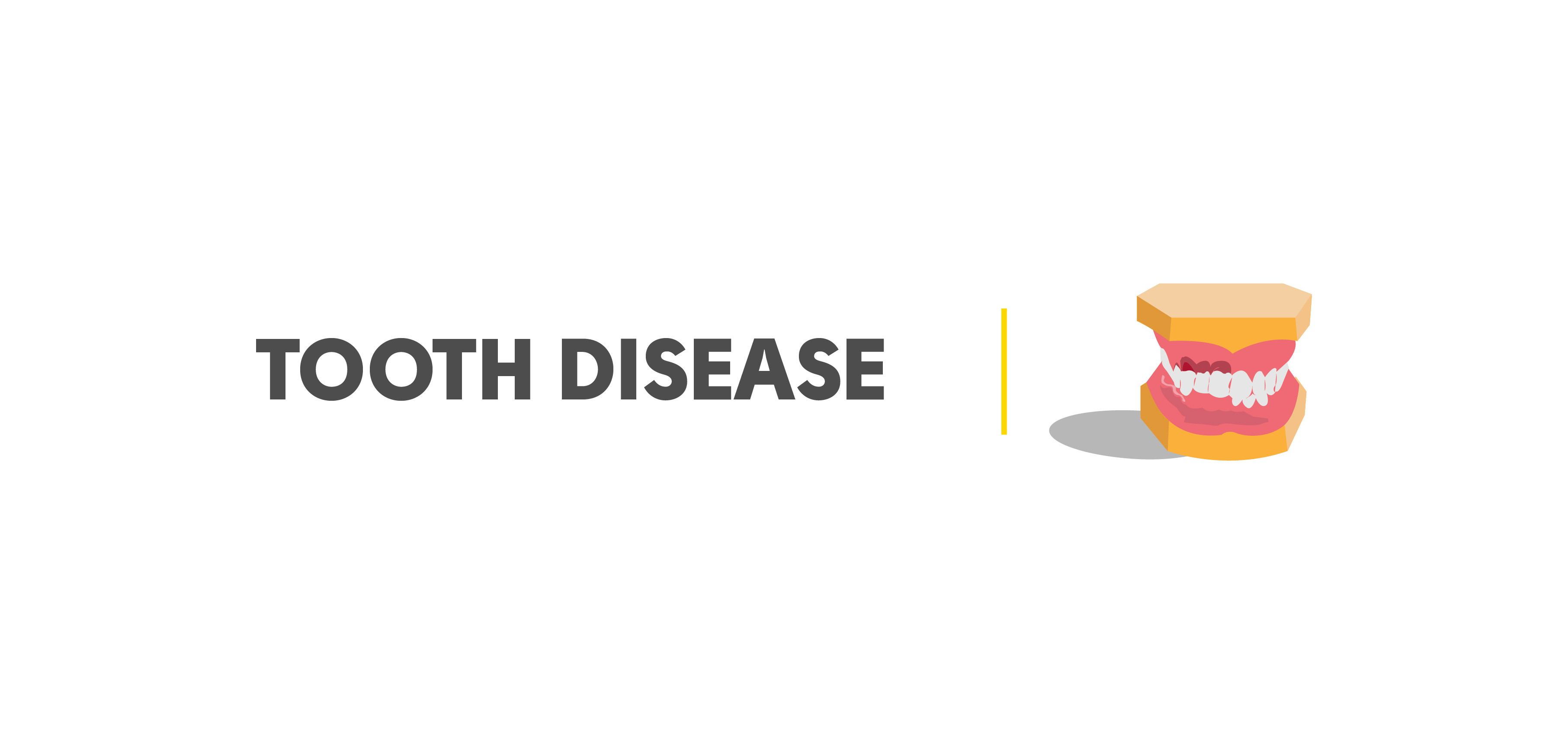 Tooth Disease